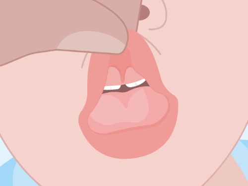 Animated smile showing lip tie