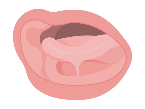 Animated mouth with buccal tie